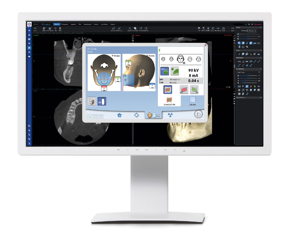 Planmeca - Planmeca ProMax® 3D Classic - ProTouch
