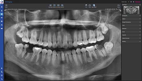 Planmeca Romexis Software NWD l Planmeca Romexis Software fortschrittliche 2D-Bildgebung mit Höchstleistung