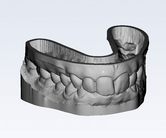 Planmeca Romexis: 3D-Modelle