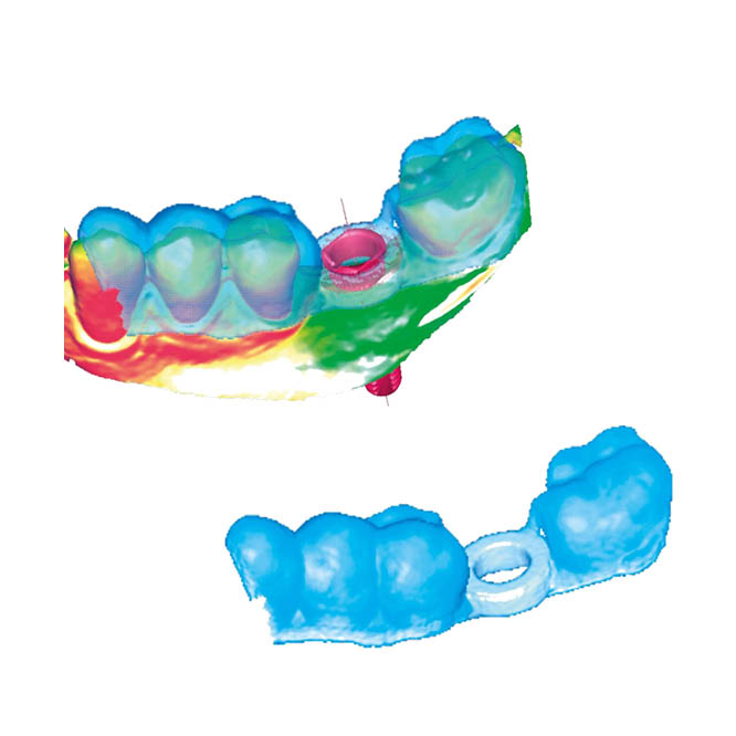 Kritisch B: rotierende oder oszillierende Instrumente für chirurgische, paradontologische oder endodontische Maßnahmen
