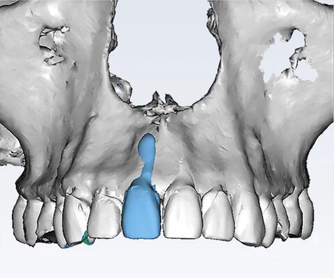 Planmeca Romexis: Ortho Studio - präzise Behandlungsplanung