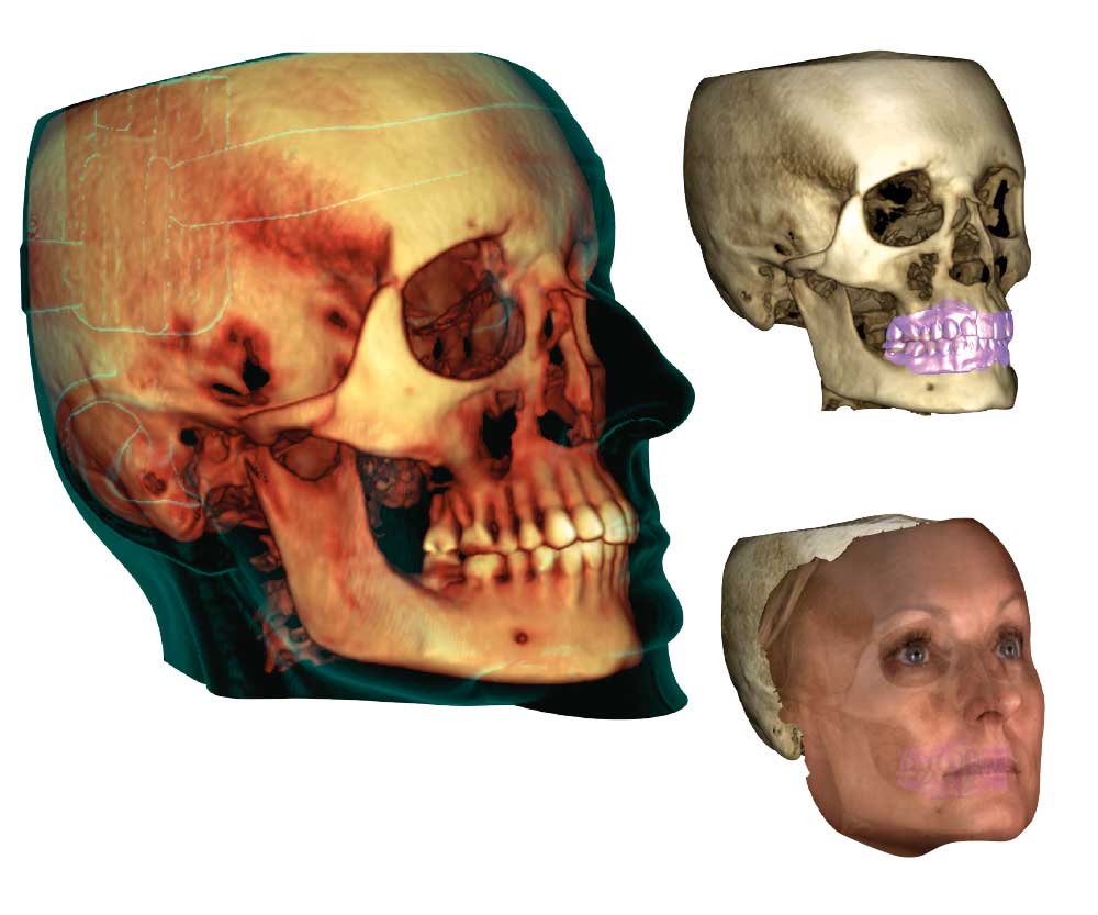 Planmeca ProMax® 3D Mid