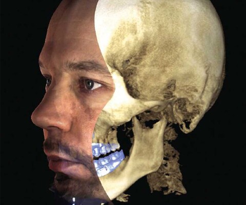 Planmeca 3D-Röntgen - vielseitige Bildgebungsoptionen für die Zahnarztpraxis
