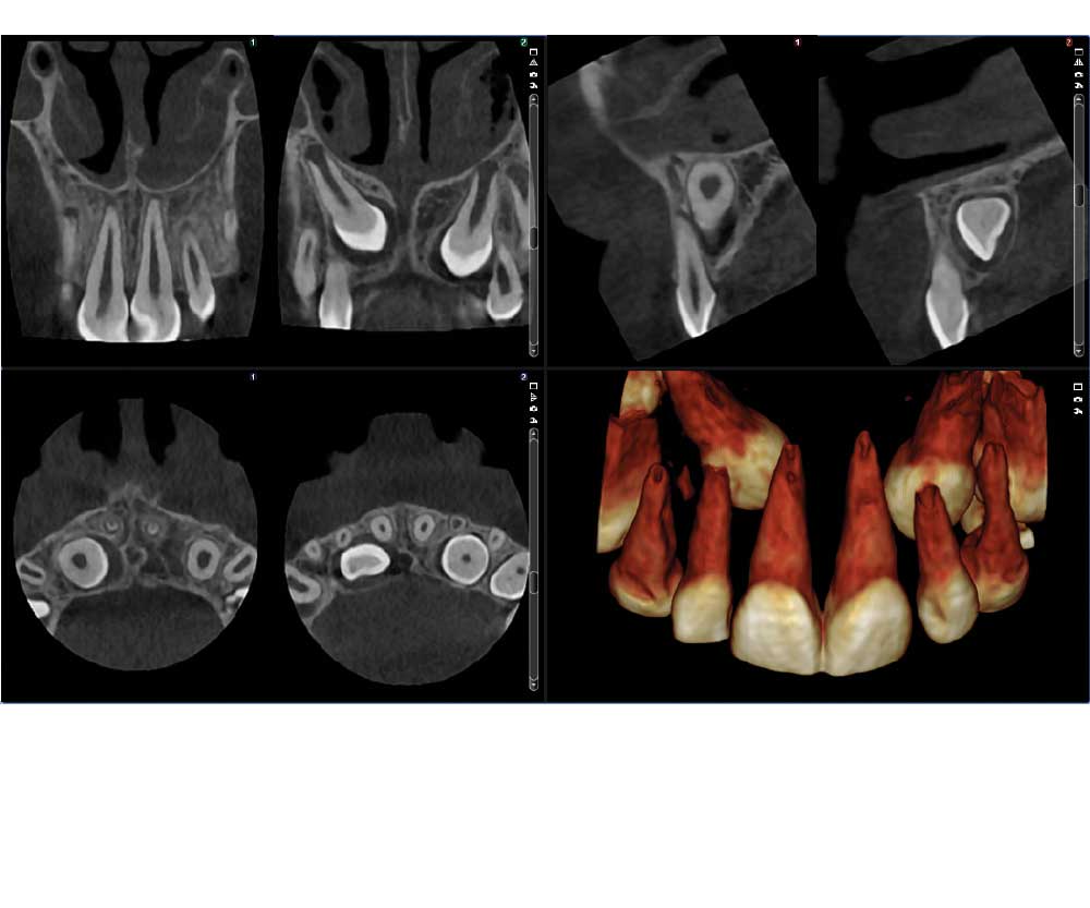 Planmeca - Planmeca ProMax® 3D Classic