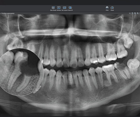 Planmeca Romexis Software CAD/CAM-Modul