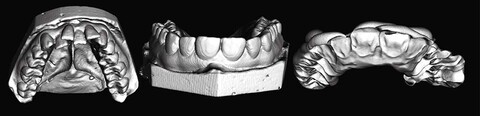 Planmeca 3D-Röntgen - 3D Modelle - erstklassige Bildqualität für die Zahnarztpraxis