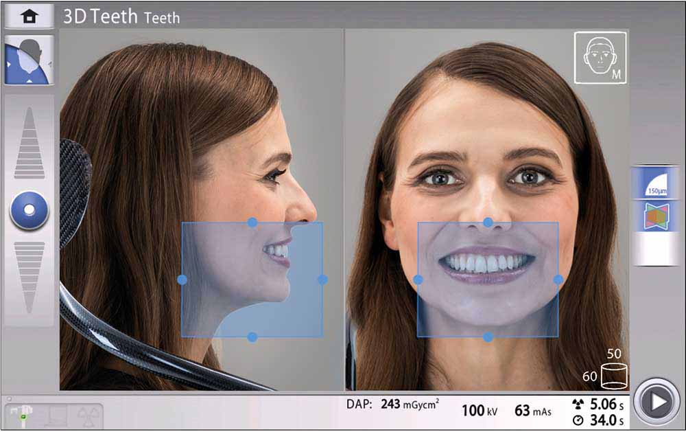 Planmeca Viso 3D-Röntgen für Zahnarztpraxis mit intelligenter Positionierungshilfe