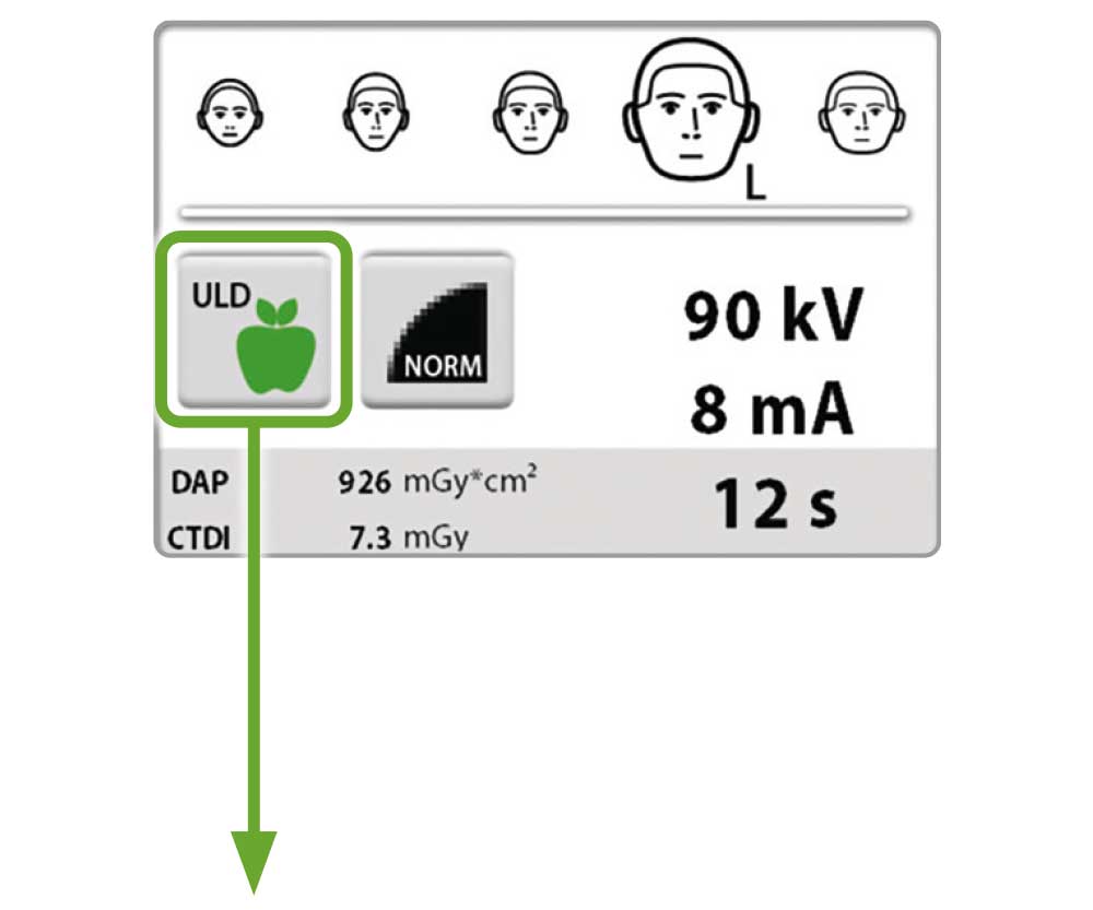 Planmeca low Dose 3D-Bildgebung