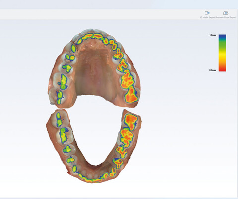 Planmeca Romexis Software CAD/CAM-Modul