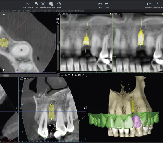 NWD - Planmeca Emerald S Intraoralscanner - der ideale Arbeitsworkflow in der Zahnarztpraxis  | nwd.de