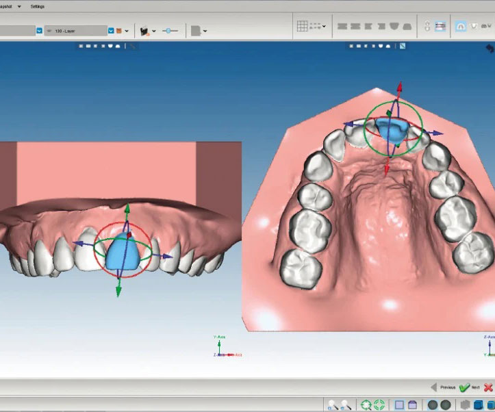 Planmeca Romexis Software Ortho Studio