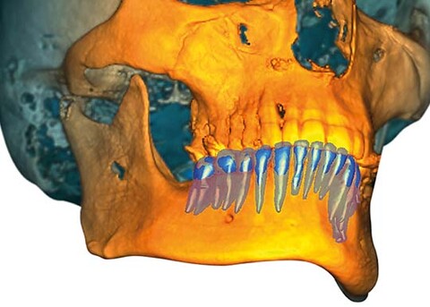 Planmeca Romexis Software fortschrittliche 3D Softwareplattform