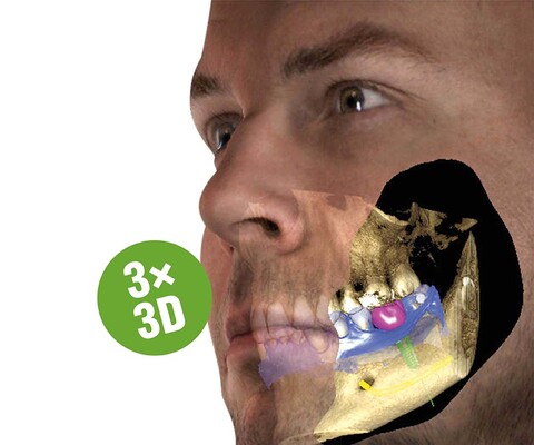 Planmeca 3D-Röntgen - erstklassige Bildqualität für die Zahnarztpraxis