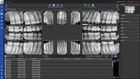 Planmeca Romexis Software fortschrittliche 2D-Bildgebung mit Höchstleistung