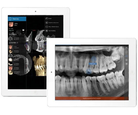 Planmeca Romexis Software Mobile App