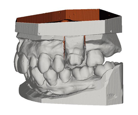 NWD - Planmeca PlanScan Lab Desktop-Scanner mit höchster Präzision für die Zahnarztpraxis | nwd.de