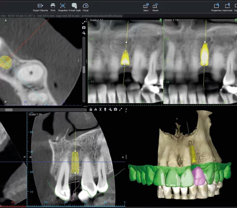 NWD - Planmeca Emerald S Intraoralscanner - der ideale Arbeitsworkflow in der Zahnarztpraxis  | nwd.de