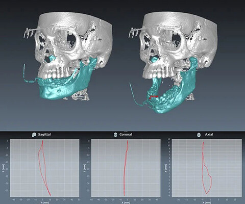 Planmeca Romexis Software 4D Jaw Motion