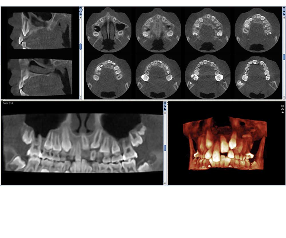 Planmeca ProMax® 3D Mid