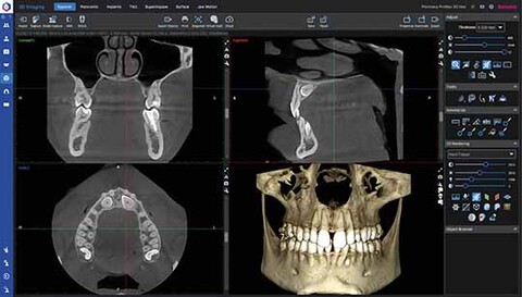 Planmeca Romexis Software leistungsstarke Softwareplattform