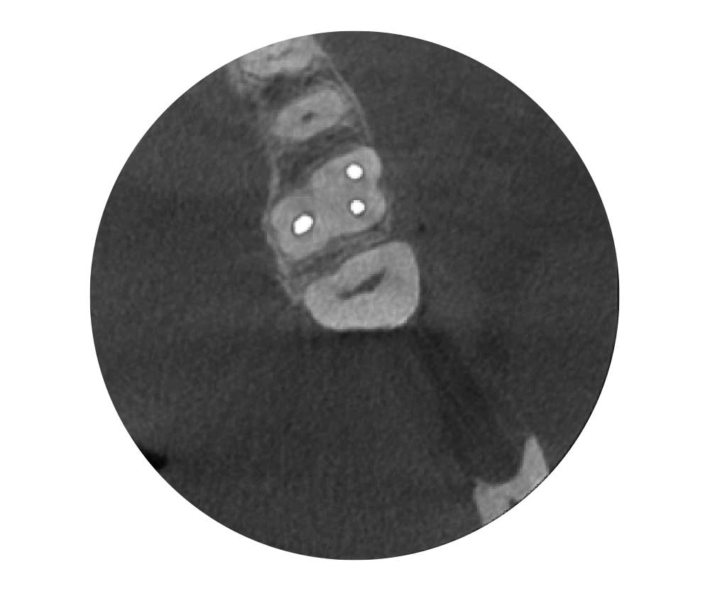 Planmeca ARA