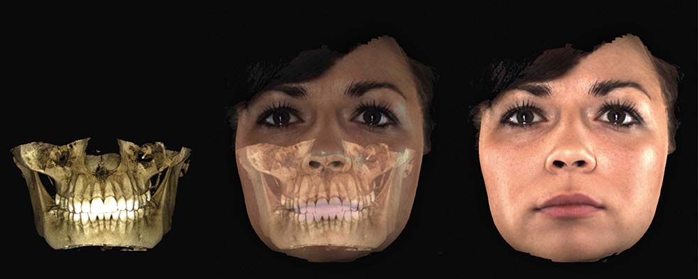 Planmeca 3D-Röntgen - 3D Modelle - erstklassige Bildqualität für die Zahnarztpraxis
